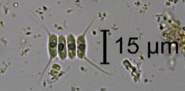 A photo of 15 um under the microscope.